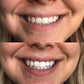 PREORDER: Cozy Smile Whitening Kit